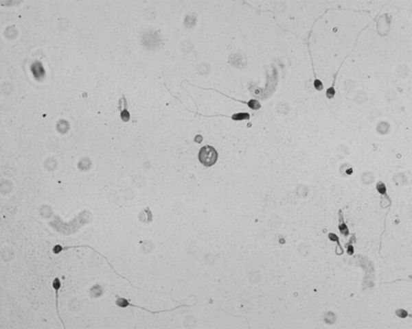 Spermien mikroskop 12 faszinierende